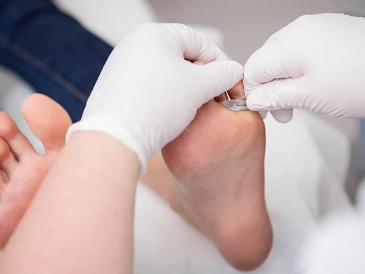 Seus pés merecem todo o cuidado e o melhor tratamento possível que só com a Cirúrgica Tatuapé oferece! Aqui você encontra um tratamento e atendimento único para cada uma de nossas clientes, de forma que garantimos a melhor experiência com nossos cuidados. Visite nossa loja de materiais médicos e hospitalares aqui no Tatuapé ou agende um horário e entre em contato atreves do nosso telefone no botão abaixo.