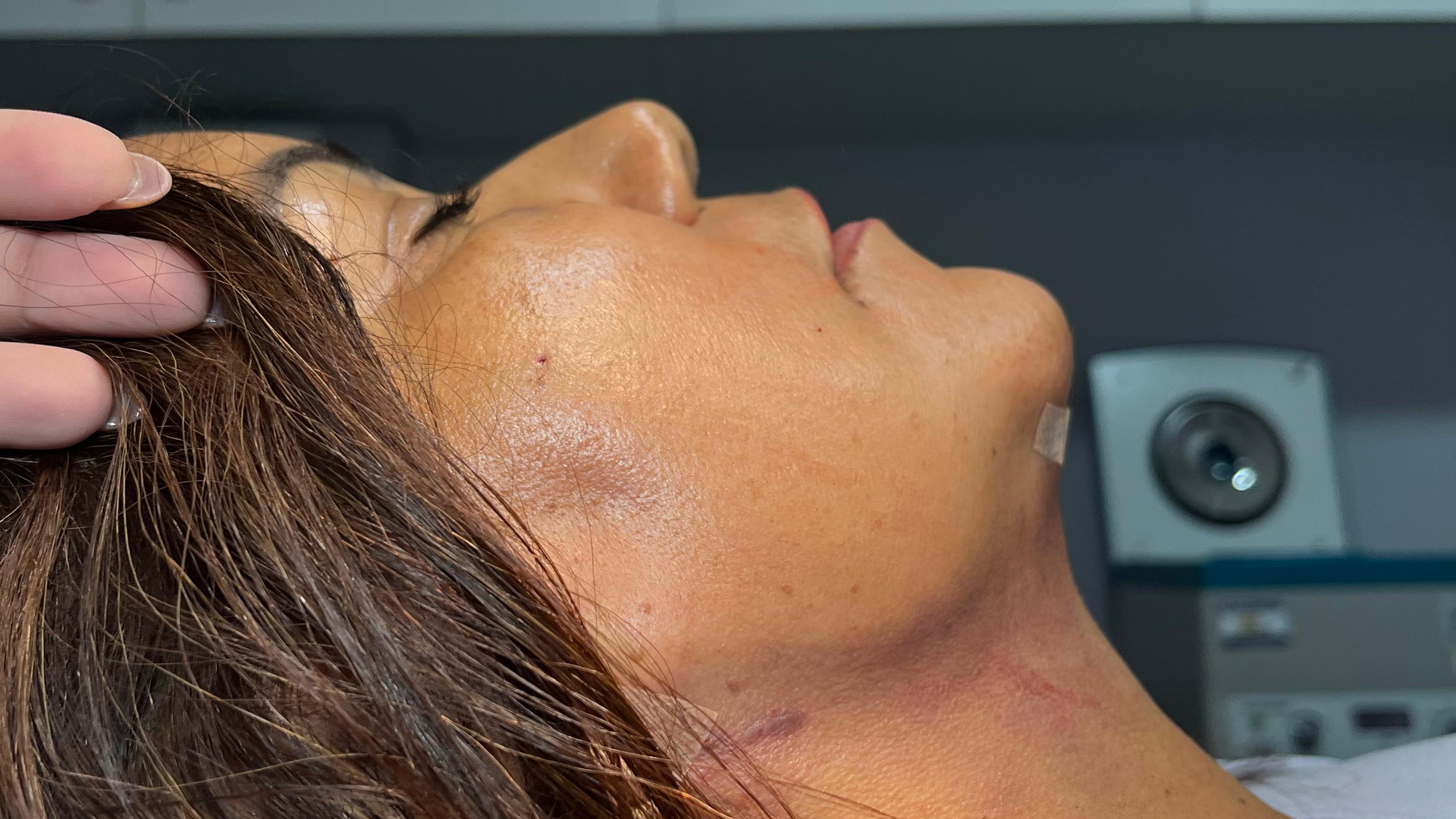 Dra Naila Lima | Lipo Cervico Facial banner